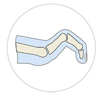 Claw Toe